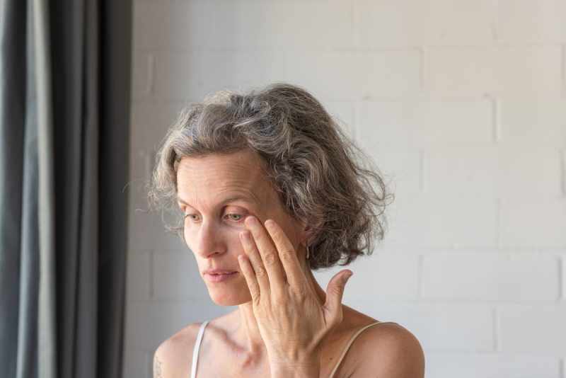 The Eyes Have It: The Causes of Fine Lines and Wrinkles