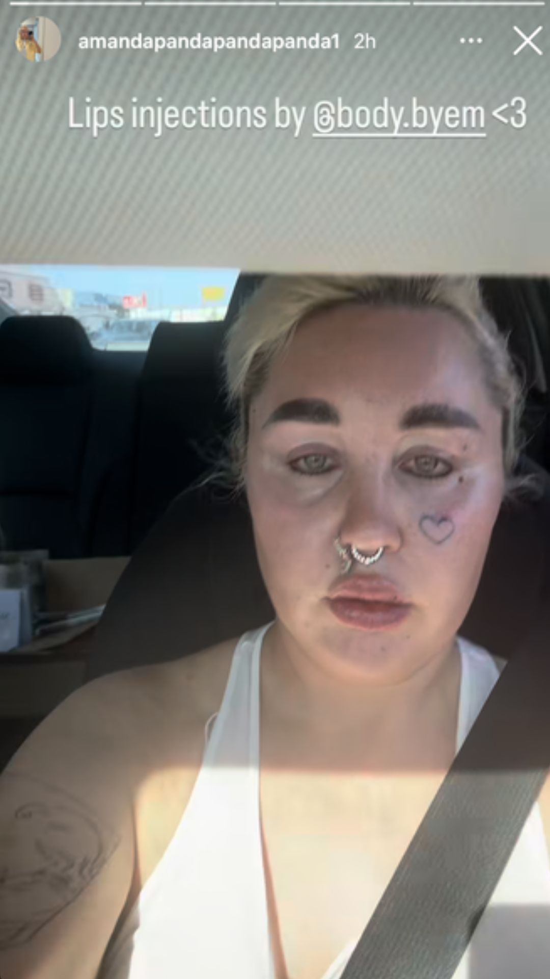 Amanda Bynes Shares New Look After Getting Lip Injections
